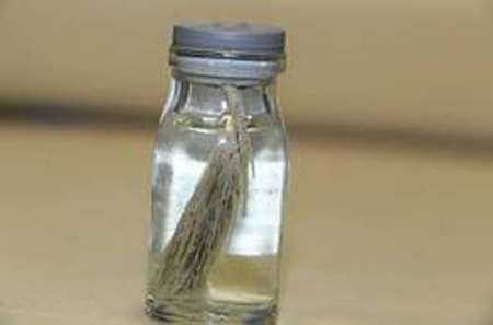 خروج خوشه گندم 6 سانتیمتری از ریه دختر 12ساله+عکس