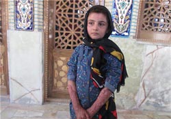 دختری که برای حفظ بلوط های زاگرس برسرجان خود معامله کرد/چشمان زهرا منتظر دستانی دلسوز است+تصویر