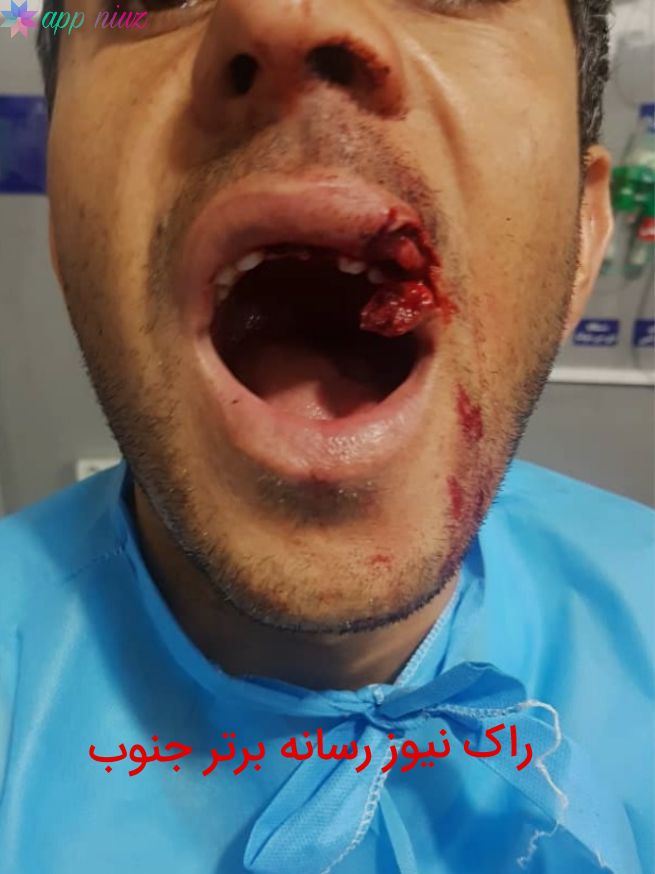 کتک کاری یکی از پرسنل بیمارستان تازه تاسیس یاسوج +تصاویر